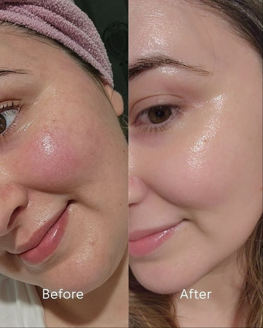 C BRIGHT BUNDLE. 1 WEEK TO BRIGHTER RADIANT SKIN (FACE / BODY)