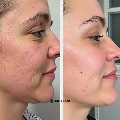 NANZSKIN Ceramide Barrier Support Balancing Cream
