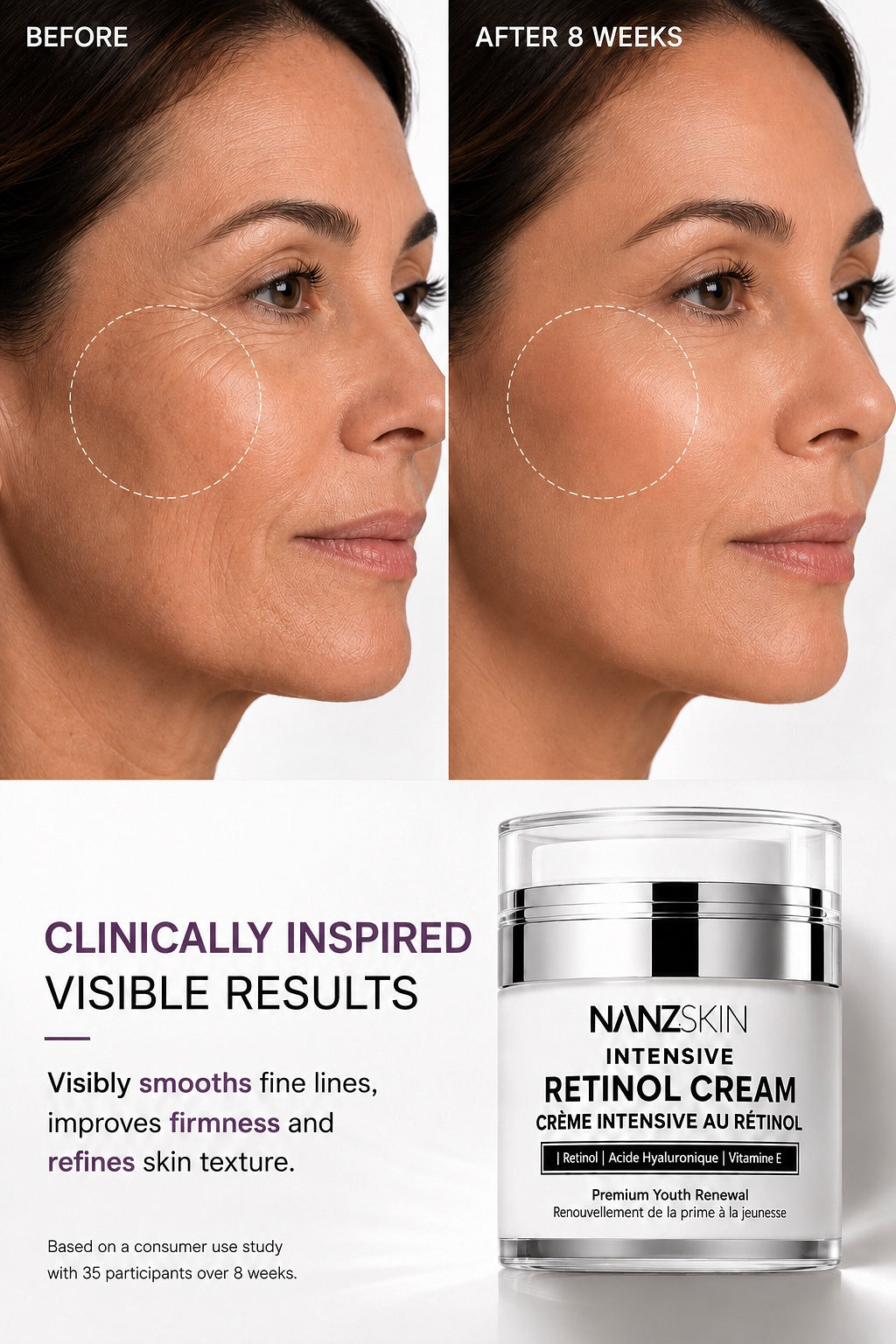 NANZSKIN Intensive Retinol Cream