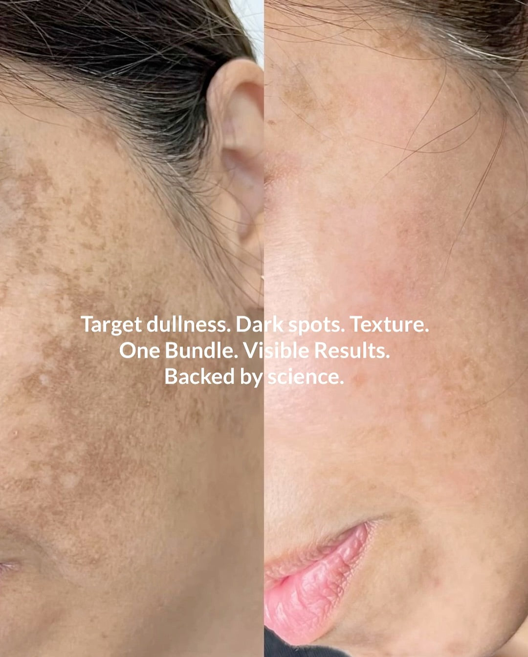 C BRIGHT BUNDLE. 1 WEEK TO BRIGHTER RADIANT SKIN (FACE / BODY)